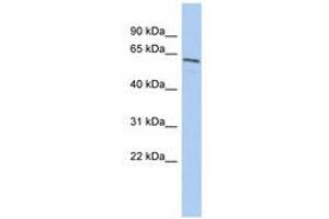 Image no. 1 for anti-Nuclear Prelamin A Recognition Factor (NARF) (AA 395-444) antibody (ABIN6741261) (NARF antibody  (AA 395-444))