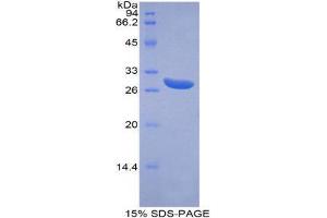 SDS-PAGE (SDS) image for ATP-Binding Cassette, Sub-Family G (WHITE), Member 1 (ABCG1) (AA 79-312) protein (His tag) (ABIN1879613)