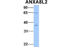 Host:  Rabbit  Target Name:  ANXA8L2  Sample Type:  Human Fetal Heart  Antibody Dilution:  1. (ANXA8L2 antibody  (Middle Region))