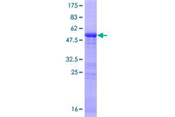 ING5 Protein (AA 1-240) (GST tag)