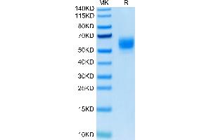 Biotinylated Human GITR Ligand/TNFSF18 Trimer on Tris-Bis PAGE under reduced condition. (TNFSF18 Protein (Trimer) (His-DYKDDDDK Tag,Biotin))