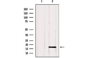 Western blot analysis of extracts from Rat muscle, using GMFG Antibody.