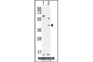 Western blot analysis of TGIF1 using rabbit polyclonal using 293 cell lysates (2 ug/lane) either nontransfected (Lane 1) or transiently transfected (Lane 2) with the TGIF1 gene. (TGIF1 antibody  (AA 145-174))