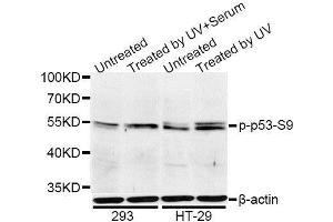 Western blot analysis of extracts of 293 and HT-29 cells, using Phospho-p53-S9 antibody. (p53 antibody  (pSer9))