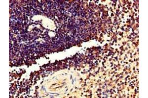 Immunohistochemistry of paraffin-embedded human spleen tissue using ABIN7173031 at dilution of 1:100 (TMEM11 antibody  (AA 1-83))