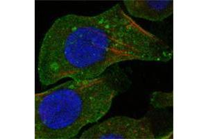 Confocal immunofluorescence analysis of A549 cells using DDR2 mouse mAb (green). (DDR2 antibody)