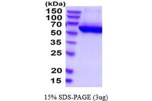 SDS-PAGE (SDS) image for Cat Eye Syndrome Chromosome Region, Candidate 1 (CECR1) (AA 30-511) protein (His tag) (ABIN5854577) (CECR1 Protein (AA 30-511) (His tag))