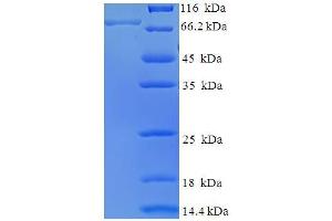 SDS-PAGE (SDS) image for BCL2-Associated Athanogene 3 (BAG3) (AA 2-577) protein (His-SUMO Tag) (ABIN4976813) (BAG3 Protein (AA 2-577) (His-SUMO Tag))