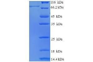 SDS-PAGE (SDS) image for BCL2-Associated Athanogene 3 (BAG3) (AA 2-577) protein (His-SUMO Tag) (ABIN5711785)