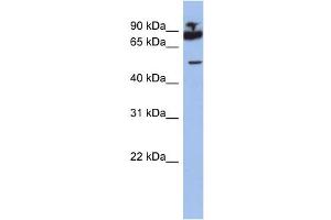 WB Suggested Anti-IKZF1 Antibody Titration:  0. (IKZF1 antibody  (Middle Region))