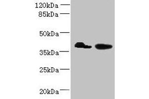 Western blot All lanes: L3HYPDH antibody at 8 μg/mL Lane 1: HepG2 whole cell lysate Lane 2: A549 whole cell lysate Secondary Goat polyclonal to rabbit IgG at 1/10000 dilution Predicted band size: 39 kDa Observed band size: 39 kDa (L3HYPDH antibody  (AA 13-312))