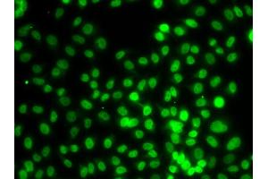 Immunofluorescence analysis of MCF-7 cells using SETD8 antibody (ABIN4905138).
