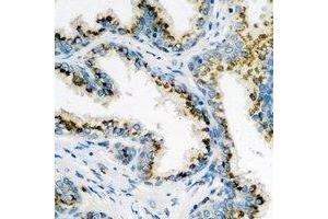 Immunohistochemical analysis of ARL6 staining in human prostate formalin fixed paraffin embedded tissue section.