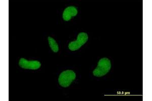 Immunofluorescence of purified MaxPab antibody to ZNF350 on HepG2 cell. (ZNF350 antibody  (AA 1-532))