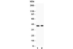 Western blot testing of IRF4 antibody and Lane 1:  HeLa;  2: Jurkat;  Predicted size: 51KD;  Observed size: 40KD (IRF4 antibody  (AA 272-451))