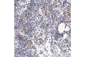 Immunohistochemical staining of human bone marrow with SLC10A5 polyclonal antibody  shows distinct nuclear and cytoplasmic positivity in subsets of bone marrow poietic cells. (SLC10A5 antibody)