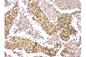 IHC analysis of EIF6 using anti-EIF6 antibody (ABIN6719594). (EIF6 antibody  (AA 66-210))