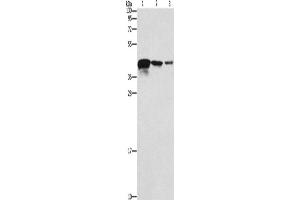 Western Blotting (WB) image for anti-Twinfilin, Actin-Binding Protein, Homolog 2 (Drosophila) (TWF2) antibody (ABIN2429402) (TWF2 antibody)