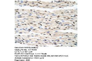 Rabbit Anti-HNRPDL Antibody  Paraffin Embedded Tissue: Human Muscle Cellular Data: Skeletal muscle cells Antibody Concentration: 4. (HNRPDL antibody  (Middle Region))