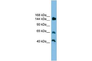 WB Suggested Anti-Jarid2 Antibody Titration: 0. (JARID2 antibody  (Middle Region))
