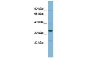 SET antibody used at 1 ug/ml to detect target protein. (SET/TAF-I antibody  (N-Term))