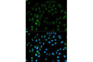 Immunofluorescence analysis of MCF7 cell using TFPI antibody. (TFPI antibody  (AA 29-224))