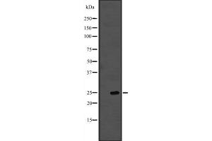Western blot analysis of PROP1 expression in A431 whole cell lysate ,The lane on the left is treated with the antigen-specific peptide.