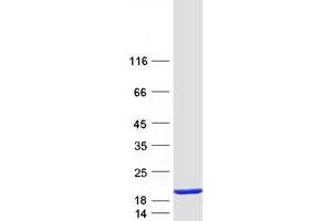 Eukaryotic Translation Initiation Factor 5A (EIF5A) (Transcript Variant B) protein (Myc-DYKDDDDK Tag)