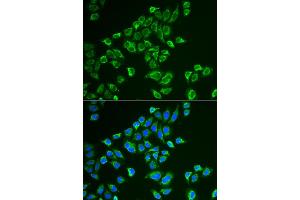 Immunofluorescence analysis of HeLa cells using TAGLN antibody. (Transgelin antibody)