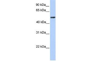 WB Suggested Anti-ZBTB9 Antibody Titration:  0. (ZBTB9 antibody  (C-Term))