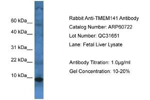 Western Blotting (WB) image for anti-Transmembrane Protein 141 (TMEM141) (C-Term) antibody (ABIN2774294) (TMEM141 antibody  (C-Term))