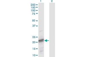 Western Blot analysis of ODAM expression in transfected 293T cell line by ODAM monoclonal antibody (M02), clone 2F8. (ODAM antibody  (AA 1-153))