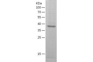 Western Blotting (WB) image for Thymidine Phosphorylase (TYMP) (AA 224-383) protein (His-IF2DI Tag) (ABIN7125384) (Thymidine Phosphorylase Protein (TYMP) (AA 224-383) (His-IF2DI Tag))
