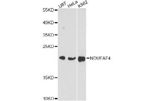 Western blot analysis of extracts of various cell lines, using NDUFAF4 antibody (ABIN6293778) at 1:3000 dilution. (NDUFAF4 antibody)