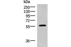 Western blot analysis of Mouse small intestines tissue lysate using PEPD Polyclonal Antibody at dilution of 1:1000 (PEPD antibody)