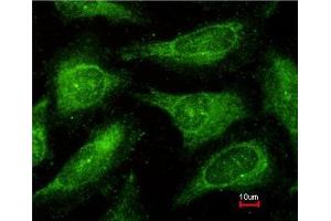 Immunofluorescence analysis of methanol-fixed HeLa, using c-Yes antibody at 1:200 dilution. (YES1 antibody)