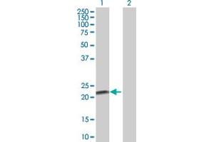 Western Blot analysis of FKBP11 expression in transfected 293T cell line by FKBP11 MaxPab polyclonal antibody. (FKBP11 antibody  (AA 1-201))