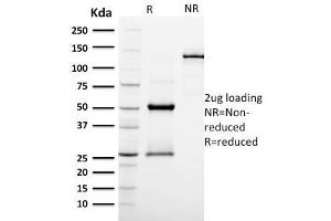 SDS-PAGE Analysis Purified EGFR Mouse Monoclonal Antibody (GFR/2596). (PODXL antibody  (AA 310-447))