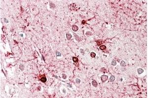 anti-GLUD1 / GLUD2 (Internal Region) antibody