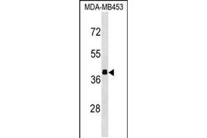 Western blot analysis in MDA-MB453 cell line lysates (35ug/lane). (ALDOB antibody  (N-Term))