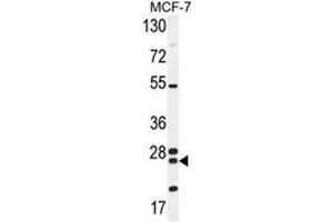 Western blot analysis of NUDT8 Antibody (N-term) in MCF-7 cell line lysates (35ug/lane).