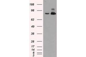 Western Blotting (WB) image for anti-Aconitase 2, Mitochondrial (ACO2) antibody (ABIN1496410) (ACO2 antibody)