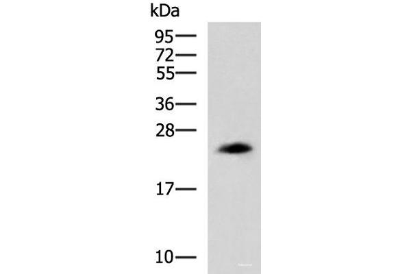 CLTB antibody