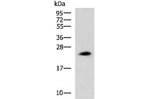 Western blot analysis of NIH/3T3 cell lysate using CLTB Polyclonal Antibody at dilution of 1:800 (CLTB antibody)