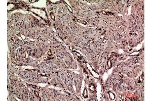 Immunohistochemistry (IHC) analysis of paraffin-embedded Human Uterus, antibody was diluted at 1:100. (OAS2 antibody  (Internal Region))