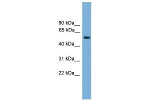 WB Suggested Anti-FOXN3 Antibody Titration: 0. (FOXN3 antibody  (Middle Region))