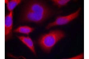 Immunofluorescence staining of methanol-fixed Hela cells using AMPKa1(Phospho-Ser487)Antibody. (AMPK alpha antibody  (pSer487))