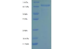 SDS-PAGE (SDS) image for Hypoalphalipoproteinemia, Primary (HYALP) (AA 36-490) protein (His-SUMO Tag) (ABIN5710408)