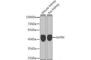 Western blot analysis of extracts of various cell lines using GATM Polyclonal Antibody at dilution of 1:1000.