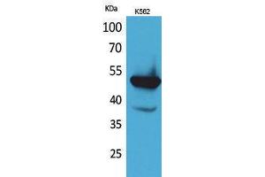 Western Blotting (WB) image for anti-Vitamin K-dependent protein C (PROC) (Internal Region) antibody (ABIN3178252) (PROC antibody  (Internal Region))